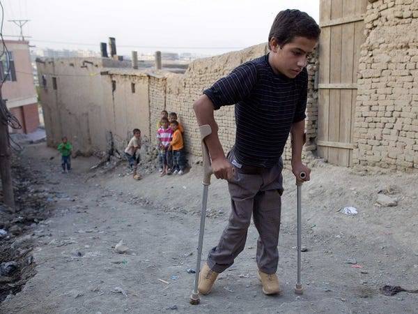 Another polio case reported in Punjab, nationwide tally hits 49
