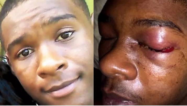 White Canadian cop convicted of beating black teen