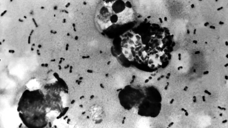 WHO monitoring China bubonic plague situation