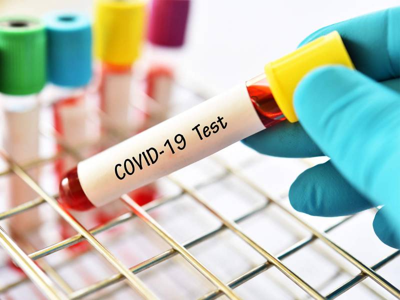 Pakistan Covid positivity ratio stands at 7.12 percent
