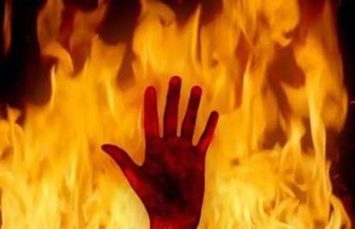 Man sets wife, kids on fire in Lahore