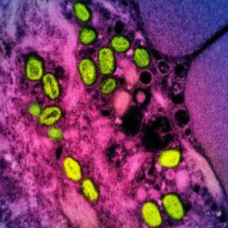 US begins clinical trial to test monkeypox vaccine