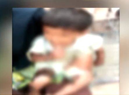 labourer’s family – a couple and their one-and-half-year-old daughter – got acid burns in an acid-throwing incident in Toba Tek Singh on Wednesday over so-called old enmity