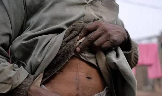 Punjab police bust organ trafficking ring