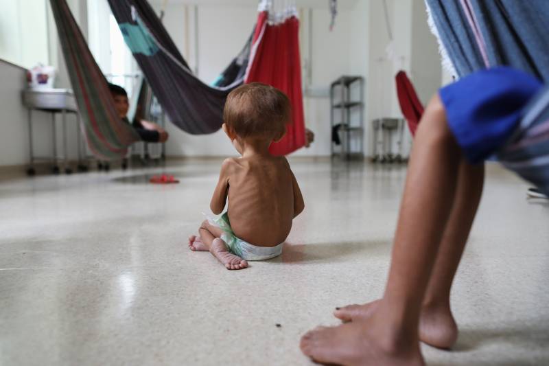 A malnourished Yanomami indigenous toddler is seen on treatment inside a ward dedicated to indigenous people of the Santo Antonio Children's Hospital in Boa Vista, Roraima state, Brazil. AFP