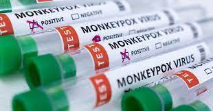 NIH confirms new monkeypox case in Karachi