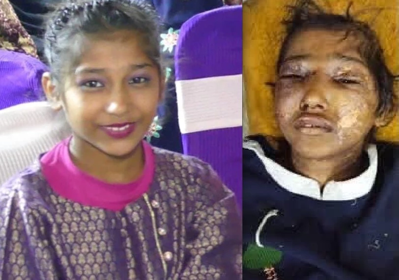 Teenage maid’s condition is critical for next 48 hours: PGMI Principal   
