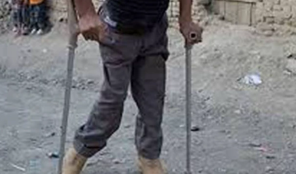 Another polio case surfaces in KP
