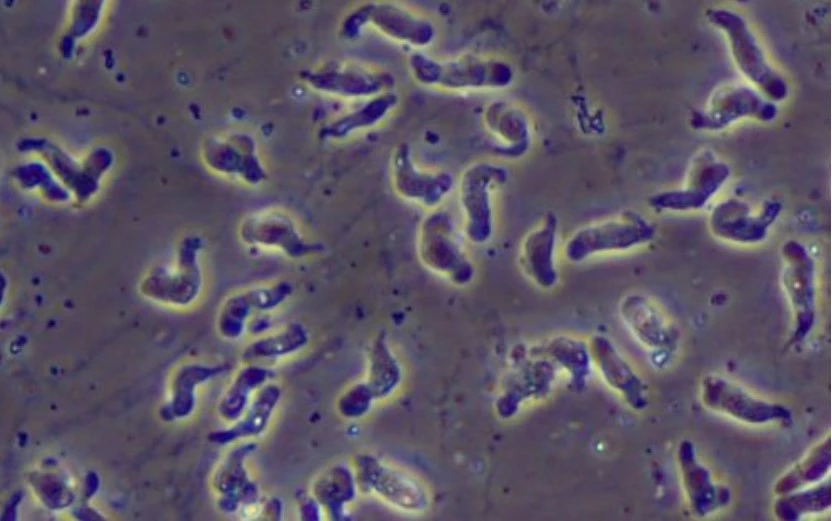 Brain-eating amoeba' kills 8 in Karachi