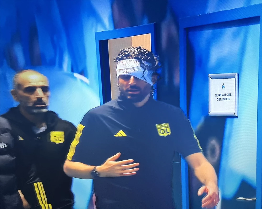 French football under microscope after Lyon team bus attack