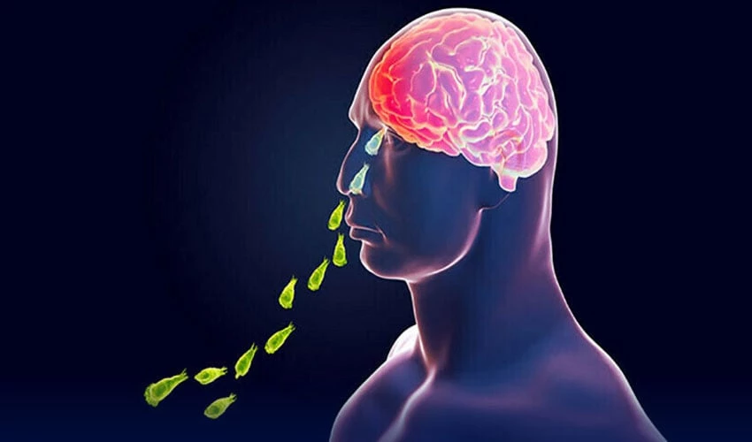 Brain-eater Naegleria claims another life in Karachi raising total to 11