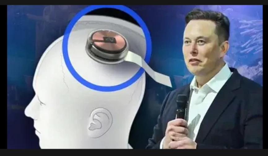 Elon Musk says Neuralink installs brain implant in first human