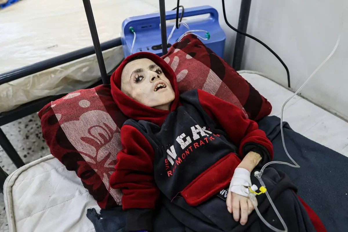 Children starving to death in northern Gaza hospitals: WHO chief
