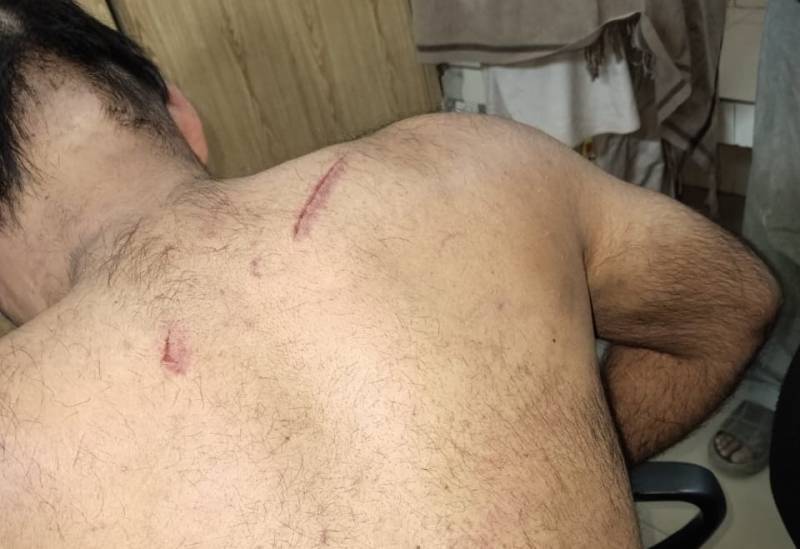 Girl's family beat her boyfriend on Valentine's Day