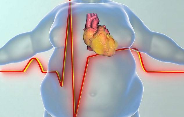 Obesity increasing risk of heart attack and stroke in young people, study warns