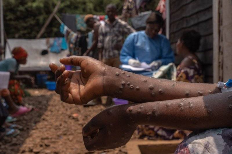 WHO decides mpox epidemic still global health emergency