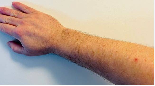 Severed human arm found in Karachi; probe launched 