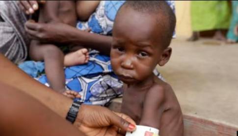 UN says aid drying up for malnourished children due to funding cuts