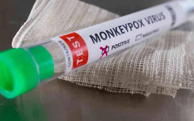First monkeypox case confirmed in Karachi