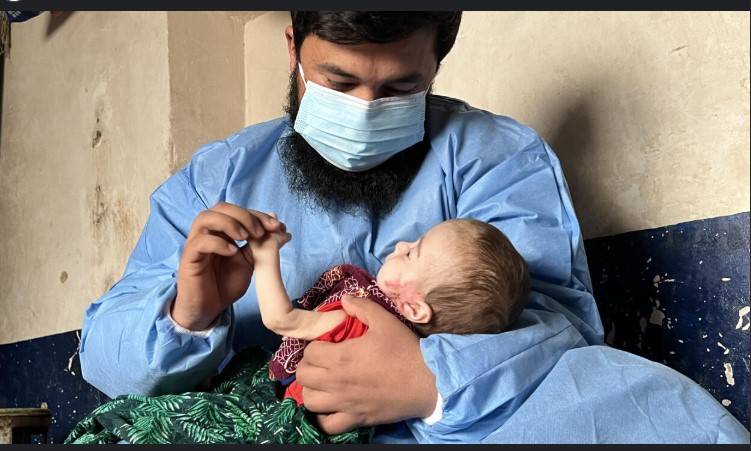 Malnourished children in Afghanistan at 'high risk of dying' without US aid