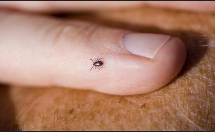 NIH issues advisories on Congo fever and heat-sunstroke