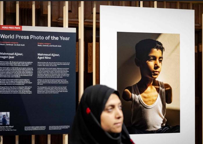 Amputee Palestinian boy image wins World Press Photo award