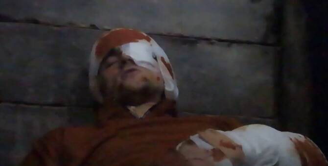 Hamas releases video of apparently injured Israeli hostage