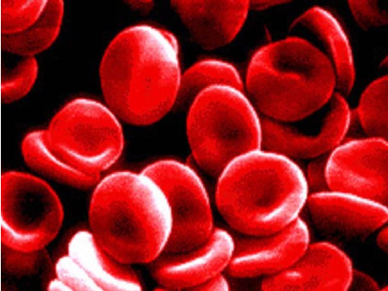 French scientists find new blood type in Guadeloupe woman