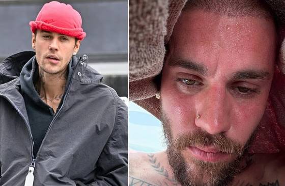 Justin Bieber shares sweaty ‘detox’ selfies amidst fans' concerns