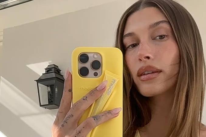 Hailey talks about stress-related skin condition amid Justin’s financial woes