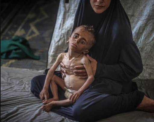 WHO says malnutrition reaching 'alarming levels' in Gaza