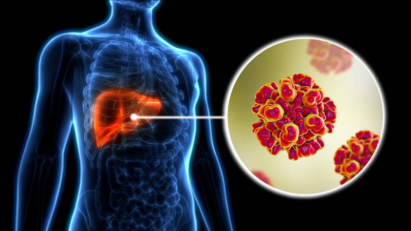 Expert recommends hygienic food, clean water, sterilised medical instruments to prevent Hepatitis spread