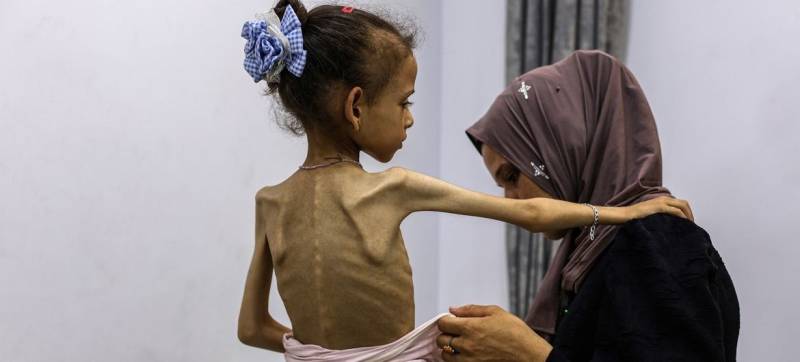 Malnourished Gaza children facing death without aid, says UN