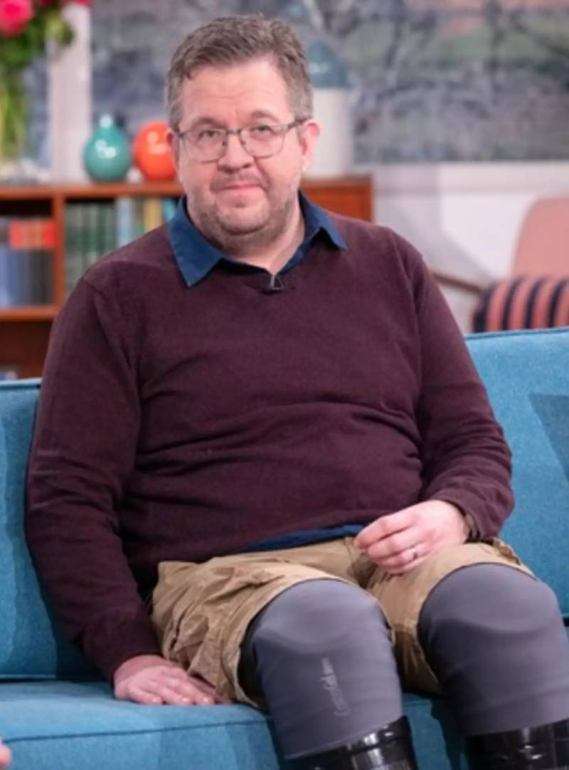 UK surgeon jailed for having his legs amputated for insurance