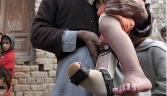 Another polio case reported in Hyderabad, total rises to 27