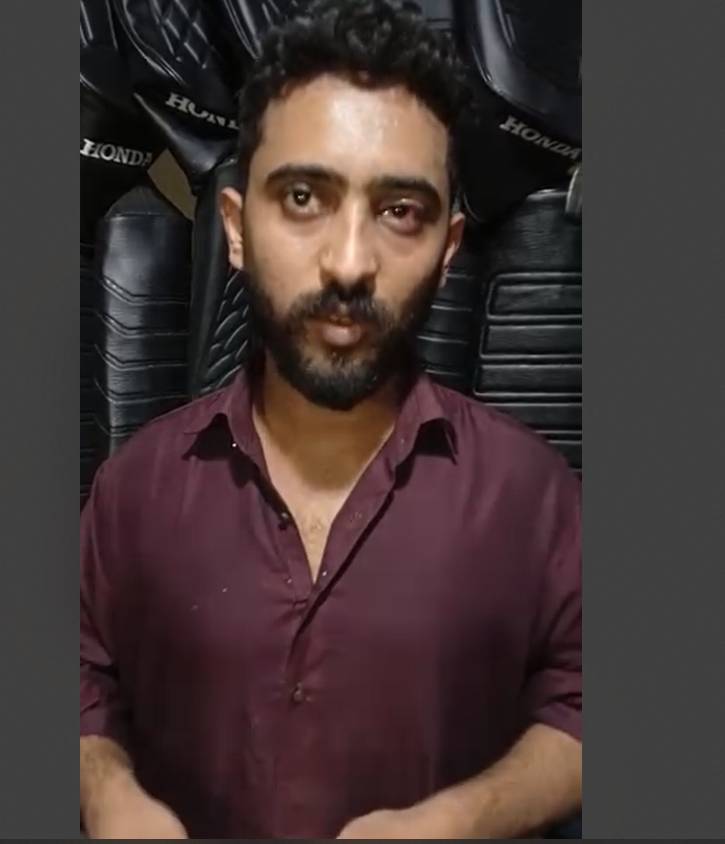Youth brutally tortured, electric shocked by Pindi police
