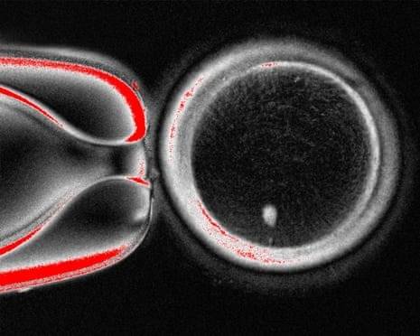 Human skin cells turned into fertilisable eggs for first time