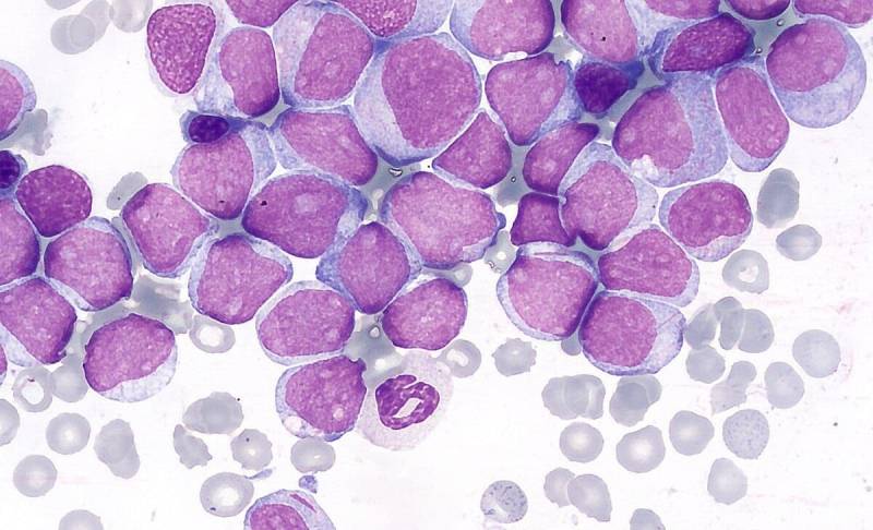 Blood chemistry may hold key to faster leukaemia diagnosis and treatment monitoring: Pakistani Study