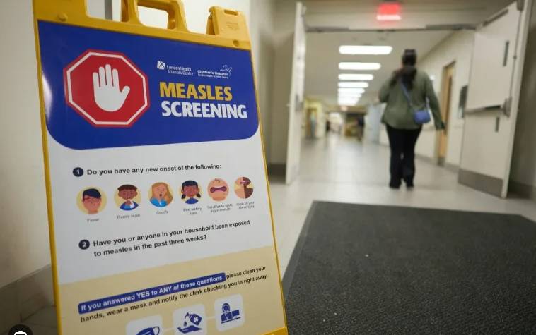 Canada reports first death linked to measles epidemic