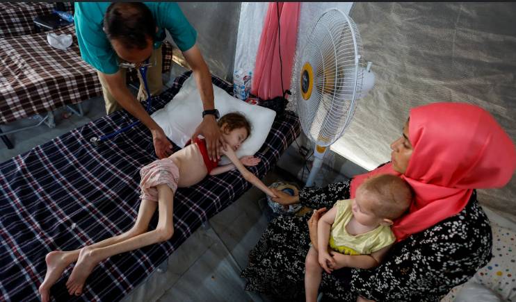 Gaza malnutrition to have 'generational' impact on newborns, UN warns