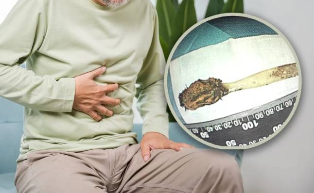 RYK doctors remove toothbrush from man’s stomach