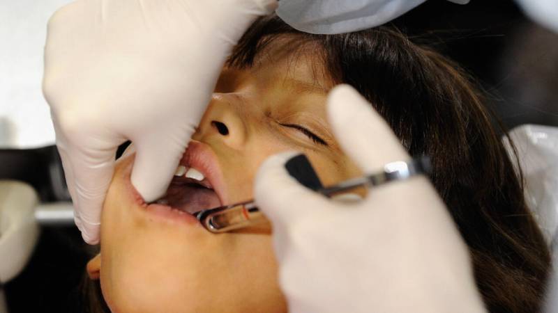 Countries agree to end mercury tooth fillings by 2034
