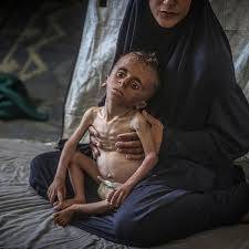 Maternal malnutrition in Gaza has 'devastating' impact on babies: UN