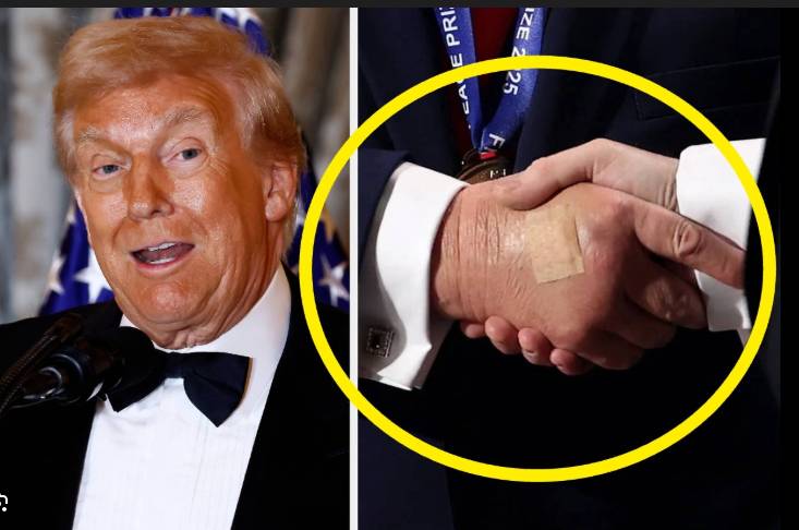 White House blames Trump's bandaged hand on handshakes