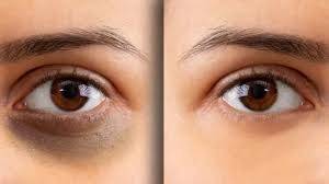 From dark circles to glowing skin: Surprising beauty benefits of coffee