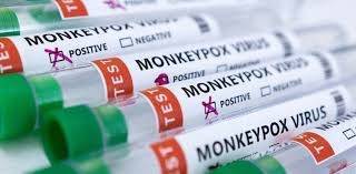 Two more cases of monkeypox reported from Faisalabad