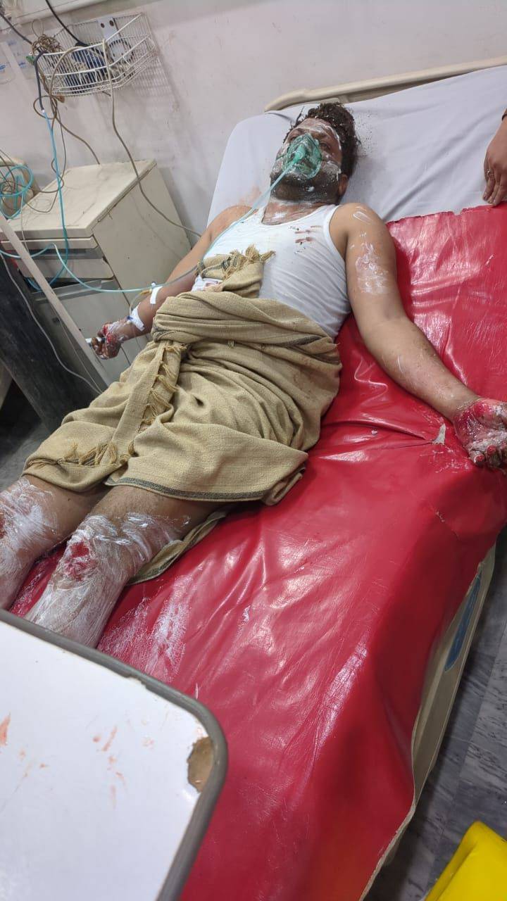 Two injured in gas cylinder blast in Pattoki