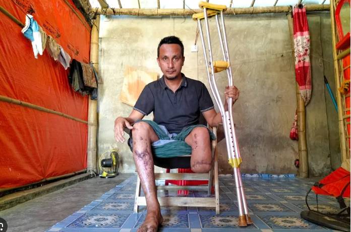 Landmines destroy limbs and lives on Bangladesh-Myanmar border