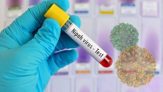 Pakistan on high alert over possible Nipah virus spread after India cases