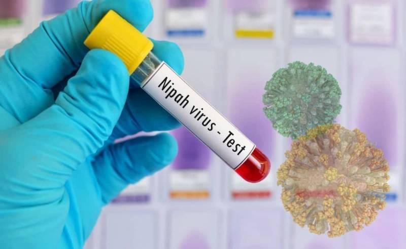 No confirmed Nipah virus case in Pakistan